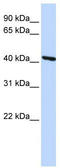 Tropomodulin 3 antibody, TA334549, Origene, Western Blot image 