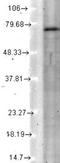 Potassium voltage-gated channel subfamily KQT member 4 antibody, NBP2-12899, Novus Biologicals, Western Blot image 