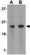 MARVEL Domain Containing 1 antibody, GTX31975, GeneTex, Western Blot image 
