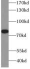Receptor-interacting serine/threonine-protein kinase 1 antibody, FNab07313, FineTest, Western Blot image 