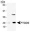 Prostaglandin-H2 D-isomerase antibody, PA1-46023, Invitrogen Antibodies, Western Blot image 