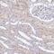Protein Kinase N3 antibody, HPA058305, Atlas Antibodies, Immunohistochemistry paraffin image 