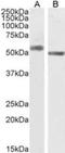 Synaptic vesicular amine transporter antibody, NB100-1479, Novus Biologicals, Western Blot image 