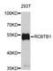 RCC1 And BTB Domain Containing Protein 1 antibody, abx127033, Abbexa, Western Blot image 