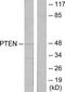 Phosphatidylinositol-3,4,5-trisphosphate 3-phosphatase and dual-specificity protein phosphatase PTEN antibody, TA313350, Origene, Western Blot image 