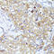Eukaryotic Translation Initiation Factor 3 Subunit L antibody, 24-005, ProSci, Immunohistochemistry frozen image 