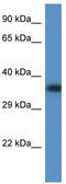 F-box only protein 32 antibody, TA338810, Origene, Western Blot image 