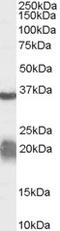 H/ACA ribonucleoprotein complex subunit 4 antibody, orb19479, Biorbyt, Western Blot image 