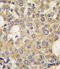 Poly(ADP-ribose) glycohydrolase antibody, 62-792, ProSci, Immunohistochemistry paraffin image 