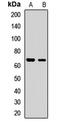 Methionyl Aminopeptidase 2 antibody, LS-C667904, Lifespan Biosciences, Western Blot image 
