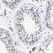Prolyl 4-Hydroxylase Subunit Beta antibody, HPA018884, Atlas Antibodies, Immunohistochemistry paraffin image 