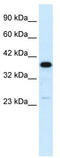 Complement Component 4 Binding Protein Beta antibody, TA334285, Origene, Western Blot image 