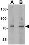 Janus Kinase And Microtubule Interacting Protein 1 antibody, GTX31867, GeneTex, Western Blot image 