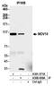 Mov10 RISC Complex RNA Helicase antibody, A500-009A, Bethyl Labs, Immunoprecipitation image 