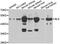 BLK Proto-Oncogene, Src Family Tyrosine Kinase antibody, LS-C349136, Lifespan Biosciences, Western Blot image 