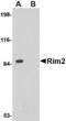 Regulating synaptic membrane exocytosis protein 2 antibody, LS-C53302, Lifespan Biosciences, Western Blot image 