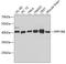 Protein Phosphatase 1 Regulatory Subunit 8 antibody, GTX32751, GeneTex, Western Blot image 