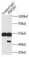 Programmed Cell Death 2 antibody, FNab06238, FineTest, Immunoprecipitation image 