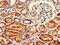 FA Complementation Group C antibody, CSB-PA008415LA01HU, Cusabio, Immunohistochemistry paraffin image 