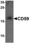 CDC28 Protein Kinase Regulatory Subunit 2 antibody, orb73394, Biorbyt, Western Blot image 