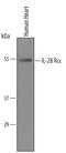 Interferon Lambda Receptor 1 antibody, PA5-47713, Invitrogen Antibodies, Western Blot image 