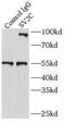 SUZ12 Polycomb Repressive Complex 2 Subunit antibody, FNab08406, FineTest, Immunoprecipitation image 