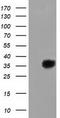LRAT Domain Containing 2 antibody, TA501993, Origene, Western Blot image 