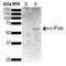 Fos Proto-Oncogene, AP-1 Transcription Factor Subunit antibody, SMC-545D-BI, StressMarq, Western Blot image 
