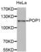 POP1 Homolog, Ribonuclease P/MRP Subunit antibody, abx004574, Abbexa, Western Blot image 