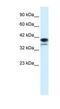Poly(ADP-Ribose) Polymerase Family Member 6 antibody, NBP1-52950, Novus Biologicals, Western Blot image 