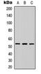 ETS Variant 4 antibody, abx121478, Abbexa, Western Blot image 