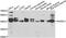 SH3 domain GRB2-like 1 antibody, MBS2535150, MyBioSource, Western Blot image 