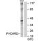 PYD And CARD Domain Containing antibody, PA5-49897, Invitrogen Antibodies, Western Blot image 
