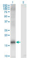 Lysine-specific demethylase 5A antibody, LS-C198065, Lifespan Biosciences, Western Blot image 