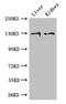 Pyruvate carboxylase, mitochondrial antibody, CSB-PA017511LA01HU, Cusabio, Western Blot image 