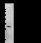 Fibroblast Growth Factor 23 antibody, 105945-T32, Sino Biological, Western Blot image 