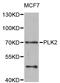 Polo Like Kinase 2 antibody, STJ29146, St John