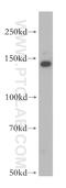 Protein SFI1 homolog antibody, 13550-1-AP, Proteintech Group, Western Blot image 