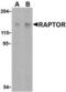 Regulatory Associated Protein Of MTOR Complex 1 antibody, TA306211, Origene, Western Blot image 