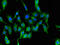 Arginyl-TRNA Synthetase antibody, CSB-PA019344LA01HU, Cusabio, Immunofluorescence image 