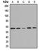 DNA Methyltransferase 1 Associated Protein 1 antibody, LS-C668858, Lifespan Biosciences, Western Blot image 