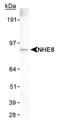 Solute Carrier Family 9 Member A8 antibody, NB110-62091, Novus Biologicals, Western Blot image 