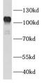BAF Chromatin Remodeling Complex Subunit BCL11B antibody, FNab00838, FineTest, Western Blot image 