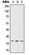 Interferon Omega 1 antibody, orb214084, Biorbyt, Western Blot image 
