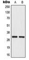Mitochondrial Ribosomal Protein L46 antibody, LS-C353393, Lifespan Biosciences, Western Blot image 