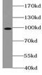DNA Topoisomerase I antibody, FNab08865, FineTest, Western Blot image 