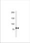 Zinc Finger Protein 219 antibody, TA324681, Origene, Western Blot image 