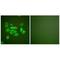Keratin 10 antibody, A02305, Boster Biological Technology, Immunohistochemistry paraffin image 