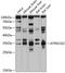 ATPase H+ Transporting V1 Subunit E2 antibody, 14-313, ProSci, Western Blot image 