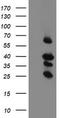 Transmembrane Protein 173 antibody, TA505016, Origene, Western Blot image 